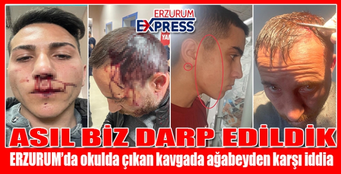 ASIL BİZ DARP EDİLDİK