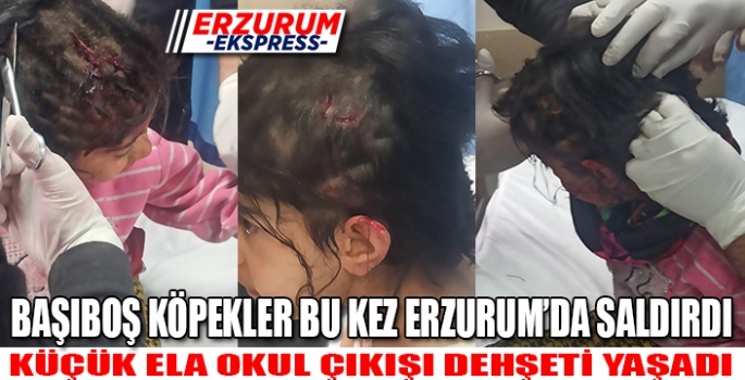 BU KEZ ERZURUM'DA KÜÇÜK BİR ÇOCUĞA SALDIRDILAR