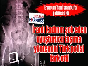 İranlı kadının şok eden uyuşturucu taşıma yöntemini Türk polisi fark etti