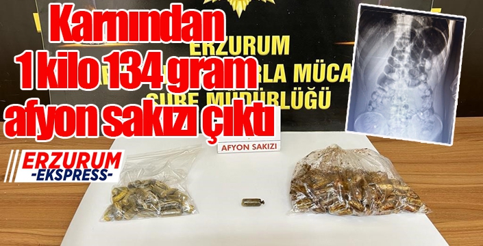 Karnından 1 kio 134 gram afyon sakızı çıktı